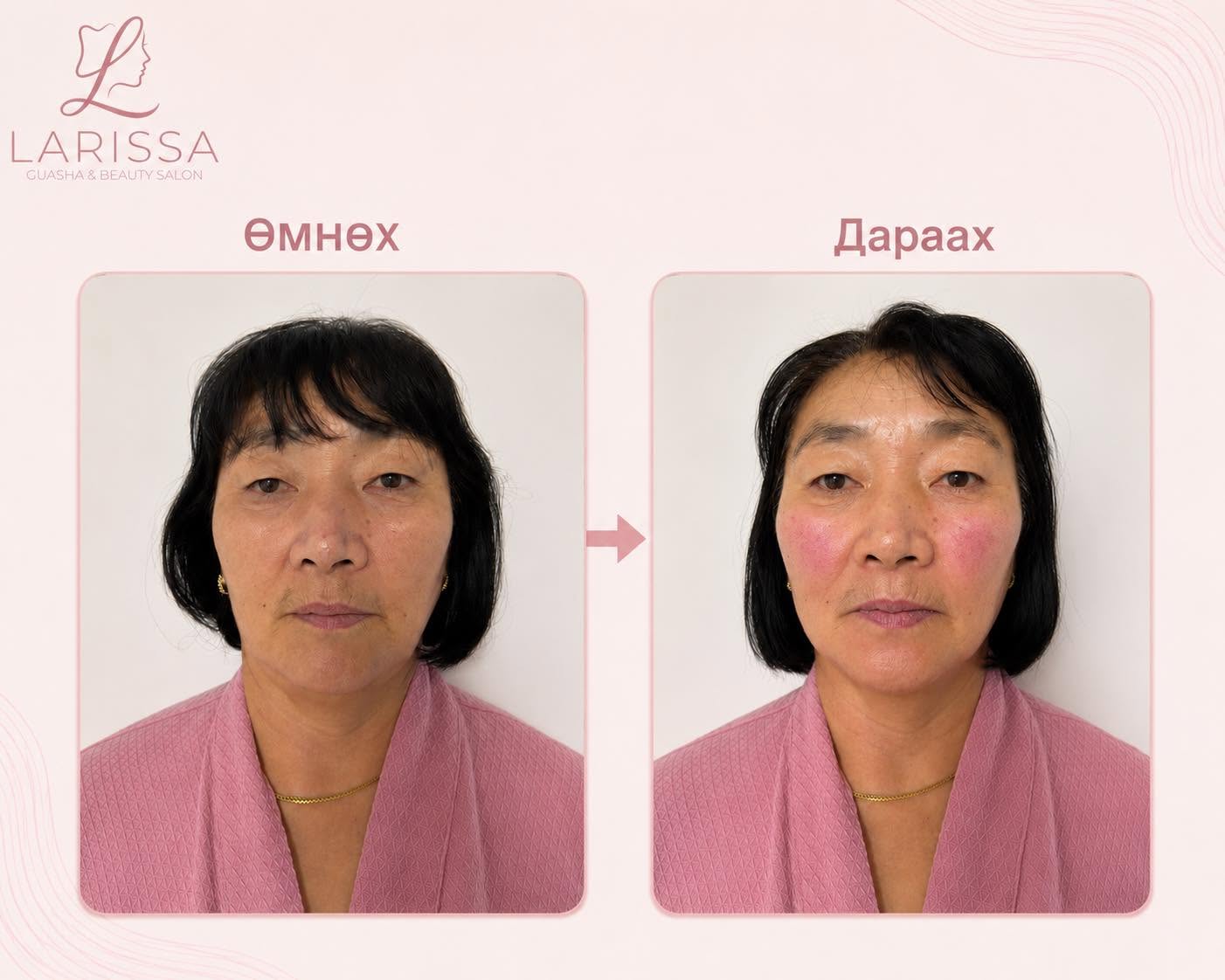 Букал гуаша