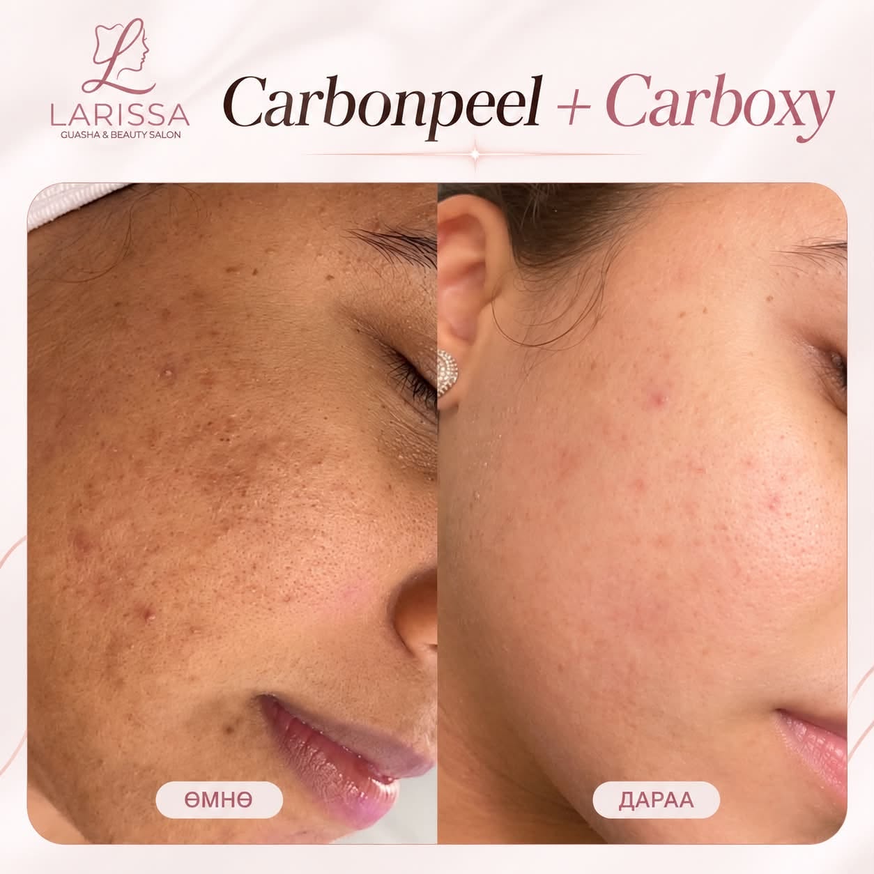 Carboxy